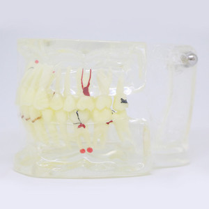 Dental teaching model removable dental teeth model