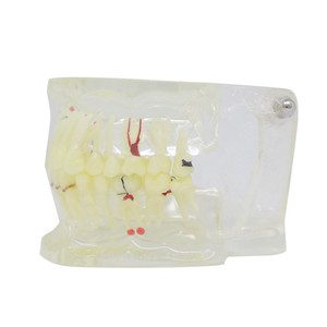 Dental teaching model removable dental teeth model