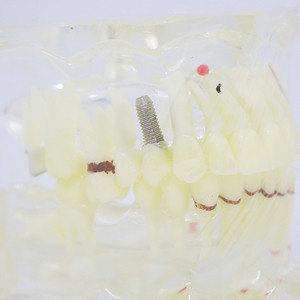 Dental teaching model removable dental teeth model