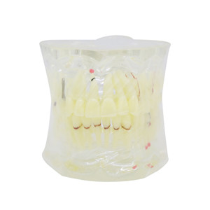 Dental teaching model removable dental teeth model