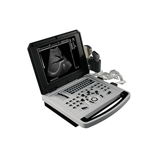 Full digital ultrasound diagnostic instrument notebook black and white B ultrasound machine