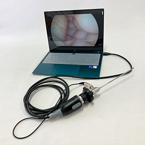 Wholesaler of high-definition endoscopic cameras  otorhinoscopes