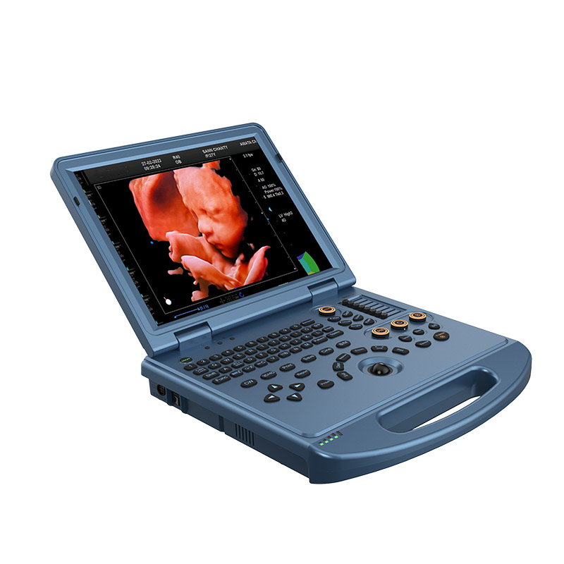Supply 4D ultrasound Doppler 3D color ultrasound manufacturer