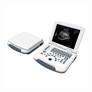 Portable laptop B/W ultrasound machine price full digital ultrasound scanner W580