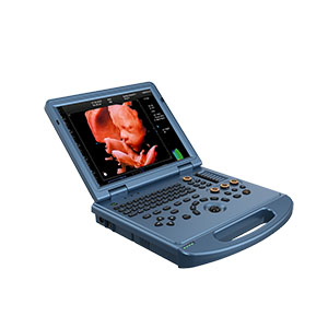 Supply 4D ultrasound Doppler 3D color ultrasound manufacturer