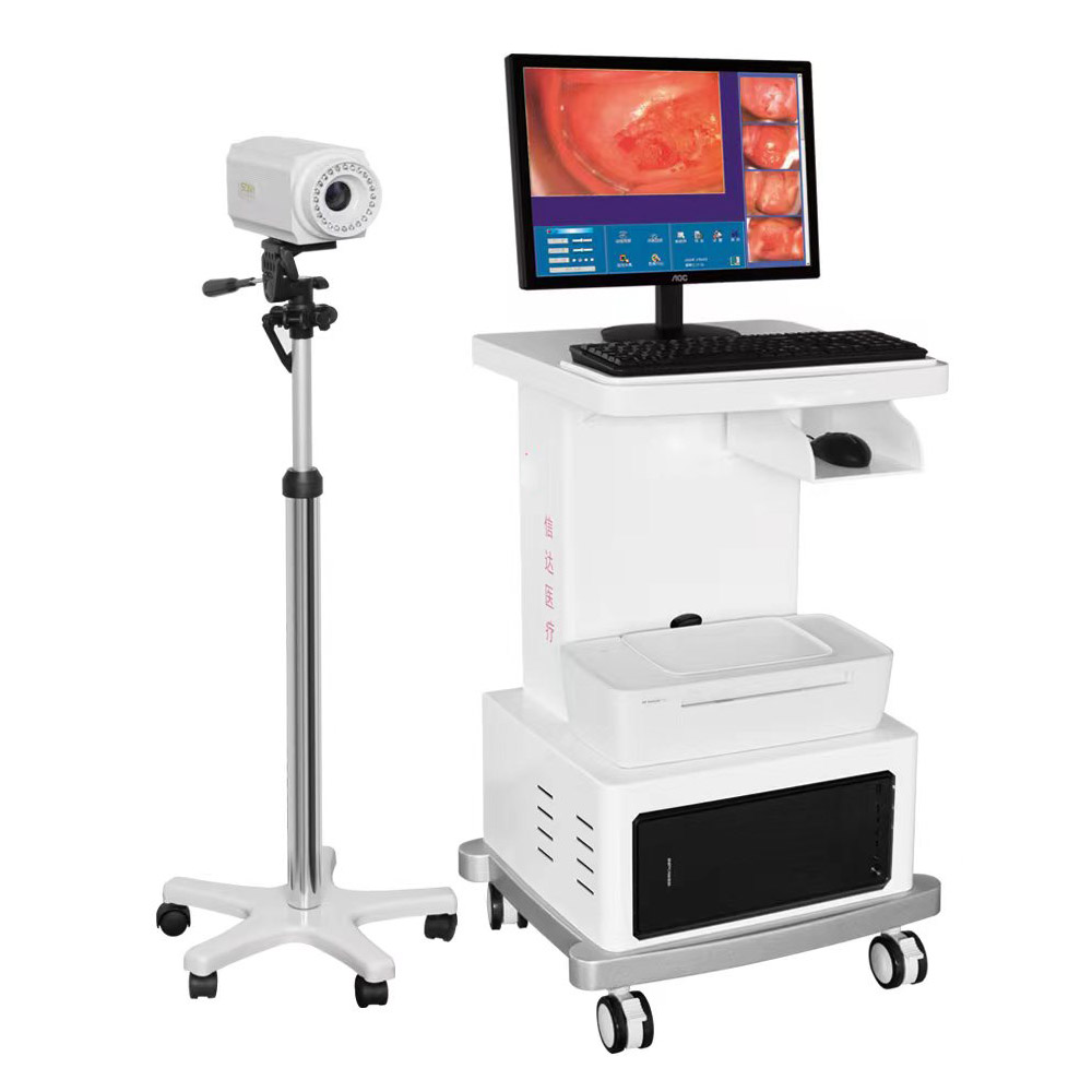 Electronic colposcopy 2 megapixel gynecologic endoscopy system